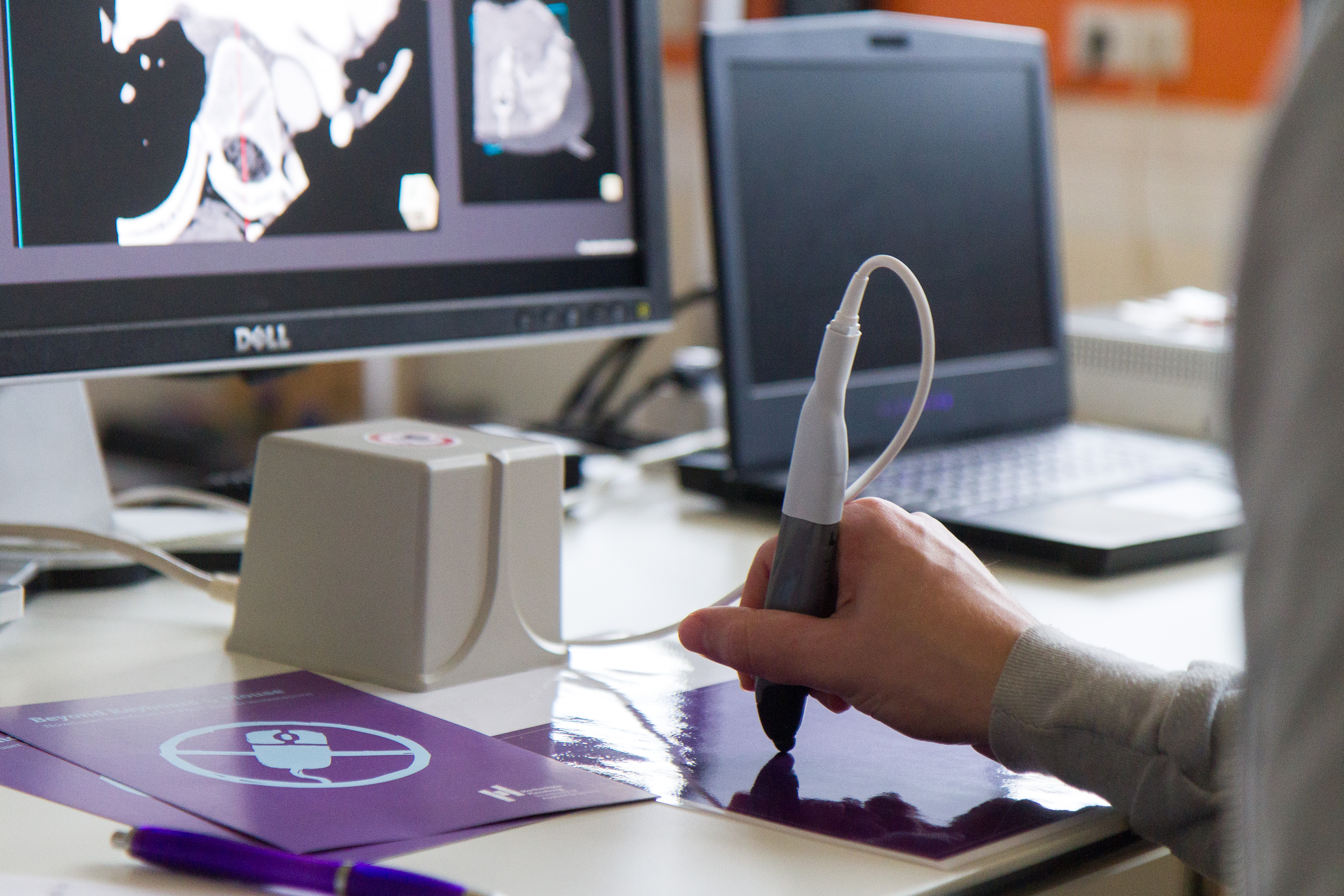 SonoGame am Desktop mit Ultraschall-Gerät im Fokus